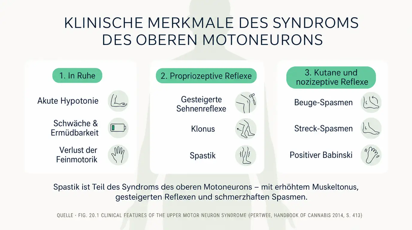 Schema des Syndroms des oberen Motoneurons mit den klinischen Merkmalen einer Spastik